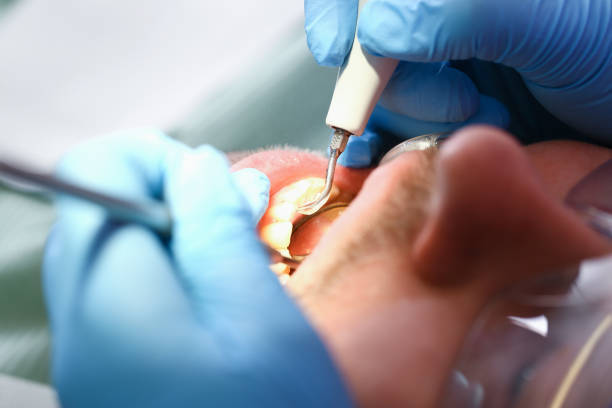 Best Pediatric Emergency Dentist in Glenmora, LA