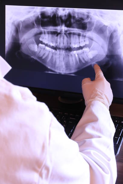 Best Walk-In Emergency Dentist in Glenmora, LA