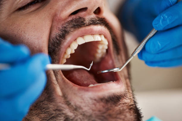 Best Weekend Emergency Dentist in Glenmora, LA