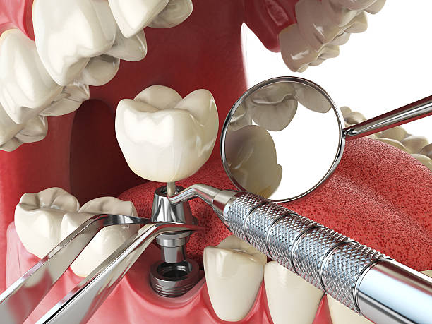 Best Emergency Dental Care for Trauma or Injury in Glenmora, LA
